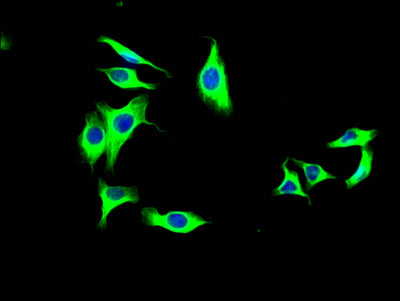 Immunofluorescence staining of HepG2 Cells with RAC07488 at 1:50, counter-stained with DAPI. The cells were fixed in 4% formaldehyde, permeated by 0.2% TritonX-100, and blocked in 10% normal Goat Serum. The cells were then incubated with the antibody overnight at 4?. Nuclear DNA was labeled in blue with DAPI. The secondary antibody was FITC-conjugated AffiniPure Goat Anti-Rabbit IgG (H+L).