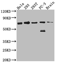 Western Blot; Positive WB detected in: Hela whole cell lysate, 293 whole cell lysate, 293T whole cell lysate, PC-3 whole cell lysate, Mouse Brain whole cell lysate; All lanes: LTA4H antibody at 1:1000; Secondary; Goat polyclonal to rabbit IgG at 1/50000 dilution; Predicted band size: 70, 60, 58, 67 kDa; Observed band size: 70 kDa