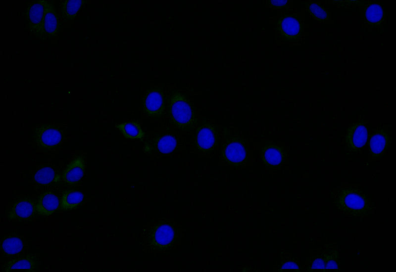 Immunofluorescence staining of HepG2 with RAC07494 at 1:25, counter-stained with DAPI. The cells were fixed in 4% formaldehyde and blocked in 10% normal Goat Serum. The cells were then incubated with the antibody overnight at 4Â°C. The secondary antibody was Alexa Fluor 505-congugated AffiniPure Goat Anti-Rabbit IgG(H+L).