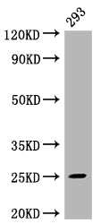 Western Blot; Positive WB detected in: 293 whole cell lysate; All lanes: Mad2L2 antibody at 1:2000; Secondary; Goat polyclonal to rabbit IgG at 1/50000 dilution; Predicted band size: 25 kDa; Observed band size: 25 kDa