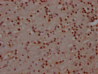 IHC image of RAC07495 diluted at 1:100 and staining in paraffin-embedded human brain tissue performed on a Leica BondTM system. After dewaxing and hydration, antigen retrieval was mediated by high pressure in a citrate buffer (pH 6.0). Section was blocked with 10% normal goat serum 30min at RT. Then primary antibody (1% BSA) was incubated at 4? overnight. The primary is detected by a Goat anti-rabbit IgG polymer labeled by HRP and visualized using 0.05% DAB.