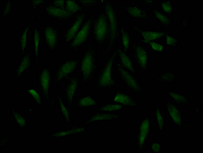 Immunofluorescence staining of Hela Cells with RAC07495 at 1:50, counter-stained with DAPI. The cells were fixed in 4% formaldehyde, permeated by 0.2% TritonX-100, and blocked in 10% normal Goat Serum. The cells were then incubated with the antibody overnight at 4?. Nuclear DNA was labeled in blue with DAPI. The secondary antibody was FITC-conjugated AffiniPure Goat Anti-Rabbit IgG (H+L).