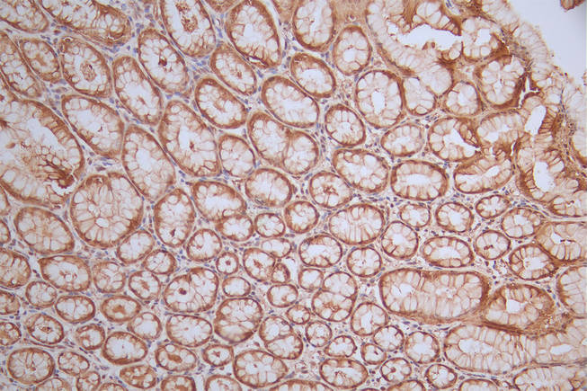 IHC image of RAC07499 diluted at 1:50 and staining in paraffin-embedded human stomach tissue performed on a Leica BondTM system. After dewaxing and hydration, antigen retrieval was mediated by high pressure in a citrate buffer (pH 6.0). Section was blocked with 10% normal goat serum 30min at RT. Then primary antibody (1% BSA) was incubated at 4Â°C overnight. The primary is detected by a Goat anti-rabbit polymer IgG labeled by HRP and visualized using 0.64% DAB.
