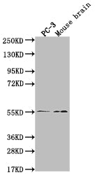Western Blot; Positive WB detected in: PC-3 whole cell lysate, Mouse brain tissue; All lanes: MAPK10 antibody at 1:2000; Secondary; Goat polyclonal to rabbit IgG at 1/50000 dilution; Predicted band size: 53, 49, 32kDa; Observed band size: 55 kDa