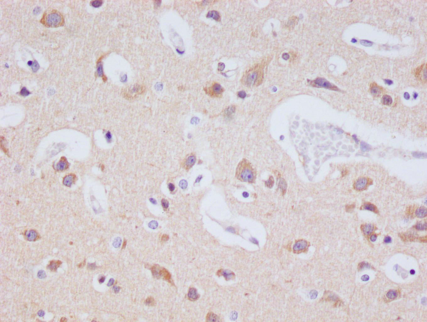 IHC image of RAC07500 diluted at 1:100 and staining in paraffin-embedded human brain tissue performed on a Leica BondTM system. After dewaxing and hydration, antigen retrieval was mediated by high pressure in a citrate buffer (pH 6.0). Section was blocked with 10% normal goat serum 30min at RT. Then primary antibody (1% BSA) was incubated at 4Â°C overnight. The primary is detected by a Goat anti-rabbit polymer IgG labeled by HRP and visualized using 0.05% DAB.