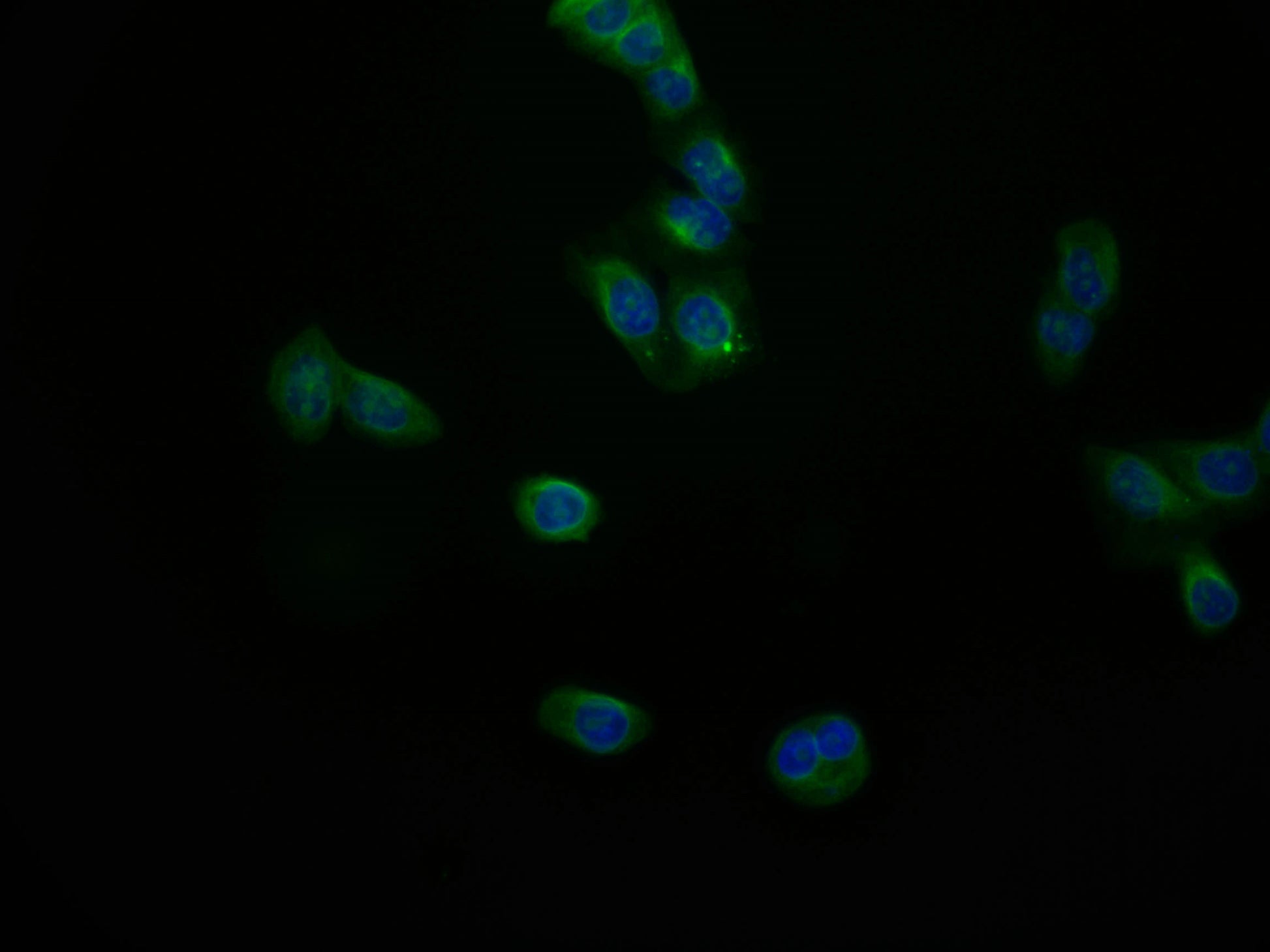 Immunofluorescence staining of PC-3 cell with RAC07500 at 1:50, counter-stained with DAPI. The cells were fixed in 4% formaldehyde and blocked in 10% normal Goat Serum. The cells were then incubated with the antibody overnight at 4Â°C. The secondary antibody was Alexa Fluor 553-congugated AffiniPure Goat Anti-Rabbit IgG(H+L).