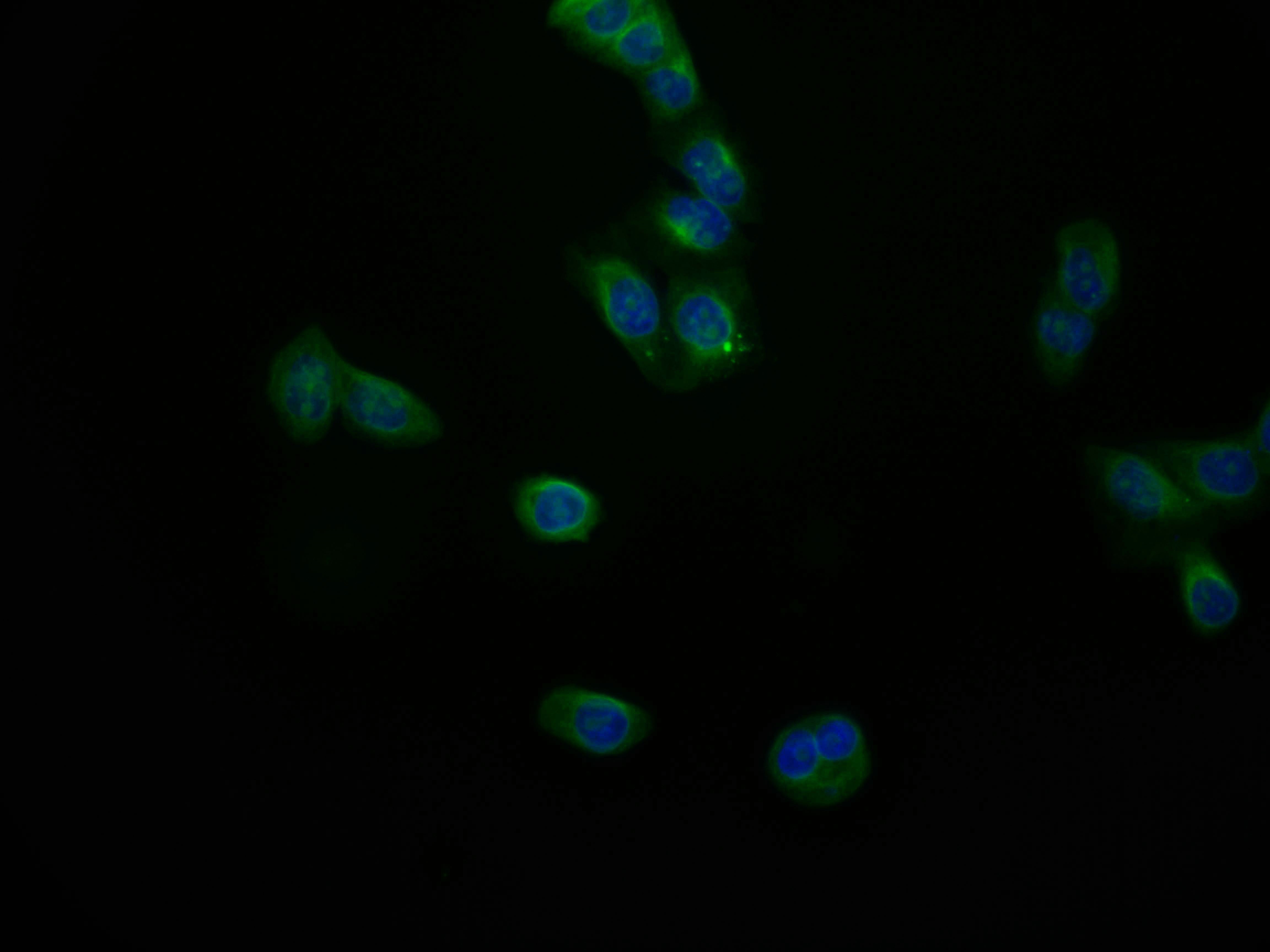 Immunofluorescence staining of PC-3 cell with RAC07500 at 1:50, counter-stained with DAPI. The cells were fixed in 4% formaldehyde and blocked in 10% normal Goat Serum. The cells were then incubated with the antibody overnight at 4Â°C. The secondary antibody was Alexa Fluor 553-congugated AffiniPure Goat Anti-Rabbit IgG(H+L).