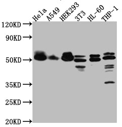 Western Blot; Positive WB detected in: Hela whole cell lysate, A549 whole cell lysate, HEK293 whole cell lysate, NIH/3T3 whole cell lysate, HL-60 whole cell lysate, THP-1 whole cell lysate; All lanes: MAPKAPK2 antibody at 1:1000; Secondary; Goat polyclonal to rabbit IgG at 1/50000 dilution; Predicted band size: 46, 43 kDa; Observed band size: 50 kDa