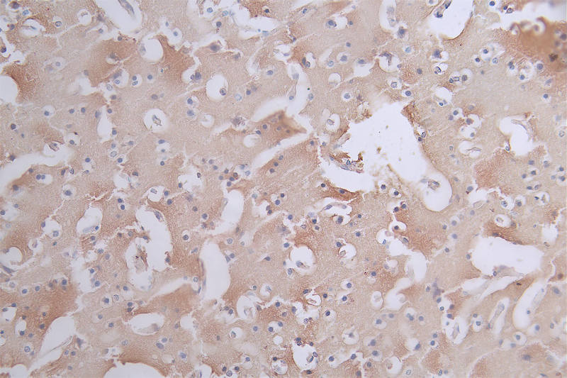 IHC image of RAC07503 diluted at 1:50 and staining in paraffin-embedded human brain tissue performed on a Leica BondTM system. After dewaxing and hydration, antigen retrieval was mediated by high pressure in a citrate buffer (pH 6.0). Section was blocked with 10% normal goat serum 30min at RT. Then primary antibody (1% BSA) was incubated at 4Â°C overnight. The primary is detected by a Goat anti-rabbit polymer IgG labeled by HRP and visualized using 0.11% DAB.
