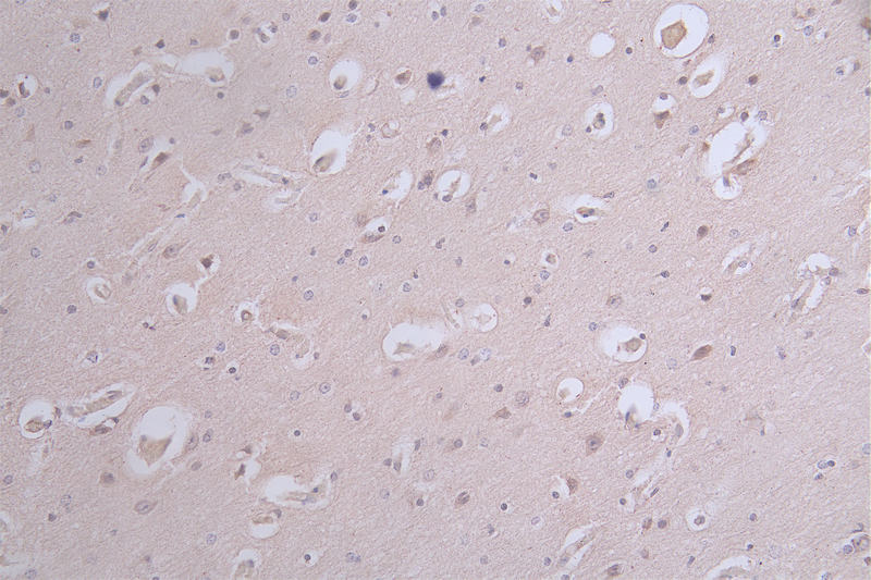 IHC image of RAC07504 diluted at 1:100 and staining in paraffin-embedded human brain tissue performed on a Leica BondTM system. After dewaxing and hydration, antigen retrieval was mediated by high pressure in a citrate buffer (pH 6.0). Section was blocked with 10% normal goat serum 30min at RT. Then primary antibody (1% BSA) was incubated at 4Â°C overnight. The primary is detected by a Goat anti-rabbit polymer IgG labeled by HRP and visualized using 0.12% DAB.
