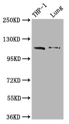 Western Blot; Positive WB detected in: THP-1 whole cell lysate, Mouse lung tissue; All lanes: MDA5 antibody at 1:2000; Secondary; Goat polyclonal to rabbit IgG at 1/50000 dilution; Predicted band size: 117, 26 kDa; Observed band size: 117 kDa