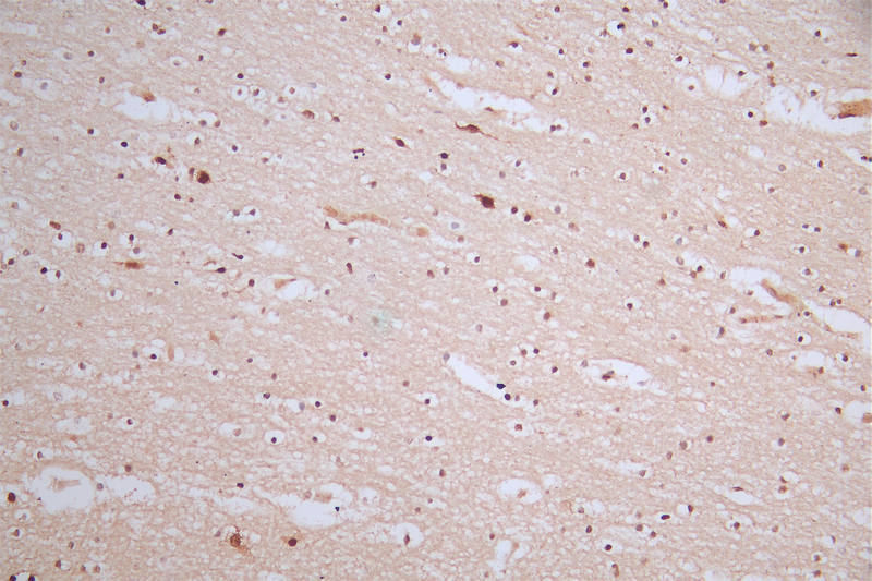 IHC image of RAC07509 diluted at 1:50 and staining in paraffin-embedded human brain tissue performed on a Leica BondTM system. After dewaxing and hydration, antigen retrieval was mediated by high pressure in a citrate buffer (pH 6.0). Section was blocked with 10% normal goat serum 30min at RT. Then primary antibody (1% BSA) was incubated at 4Â°C overnight. The primary is detected by a Goat anti-rabbit polymer IgG labeled by HRP and visualized using 0.57% DAB.