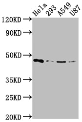 Western Blot; Positive WB detected in: Hela whole cell lysate, 293 whole cell lysate, A549 whole cell lysate, U87 whole cell lysate; All lanes: MAP2K1 antibody at 1:2000; Secondary; Goat polyclonal to rabbit IgG at 1/50000 dilution; Predicted band size: 44, 41 kDa; Observed band size: 44 kDa
