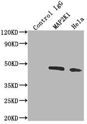 Immunoprecipitating MAP2K1 in Hela whole cell lysate; Lane 1: Rabbit control IgG instead of RAC07510 in Hela whole cell lysate.For western blotting,a HRP-conjugated Protein G antibody was used as the secondary antibody (1/2000); Lane 2: RAC07510(2ug)+ Hela whole cell lysate(500ug); Lane 3: Hela whole cell lysate (10ug)