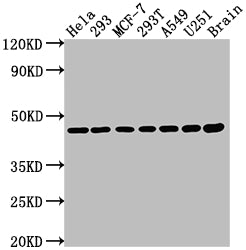 Western Blot; Positive WB detected in: Hela whole cell lysate, 293 whole cell lysate, MCF-7 whole cell lysate, 293T whole cell lysate, A549 whole cell lysate, U251 whole cell lysate, Rat brain tissue; All lanes: MAP2K1 antibody at 1:2000; Secondary; Goat polyclonal to rabbit IgG at 1/50000 dilution; Predicted band size: 44, 41 kDa; Observed band size: 44 kDa
