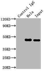 Immunoprecipitating MAP2K1 in Hela whole cell lysate; Lane 1: Rabbit control IgG instead of RAC07511 in Hela whole cell lysate.For western blotting,a HRP-conjugated Protein G antibody was used as the secondary antibody (1/2000); Lane 2: RAC07511(2ug)+ Hela whole cell lysate(500ug); Lane 3: Hela whole cell lysate (10ug)