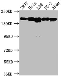 Western Blot; Positive WB detected in: 293T whole cell lysate, Hela whole cell lysate, L02 whole cell lysate, PC-3 whole cell lysate, A549 whole cell lysate; All lanes: MET antibody at 1:1500; Secondary; Goat polyclonal to rabbit IgG at 1/50000 dilution; Predicted band size: 156, 158, 86 kDa; Observed band size: 156 kDa