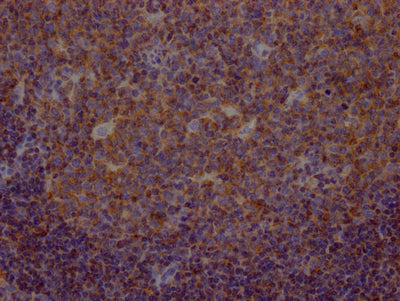 IHC image of RAC07514 diluted at 1:100 and staining in paraffin-embedded human tonsil tissue performed on a Leica BondTM system. After dewaxing and hydration, antigen retrieval was mediated by high pressure in a citrate buffer (pH 6.0). Section was blocked with 10% normal goat serum 30min at RT. Then primary antibody (1% BSA) was incubated at 4? overnight. The primary is detected by a Goat anti-rabbit IgG polymer labeled by HRP and visualized using 0.05% DAB.
