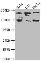 Western Blot; Positive WB detected in: Hela whole cell lysate, L02 whole cell lysate, HepG2 whole cell lysate; All lanes: MGEA5 antibody at 1:1000; Secondary; Goat polyclonal to rabbit IgG at 1/50000 dilution; Predicted band size: 103, 96, 77, 97 kDa; Observed band size: 130 kDa