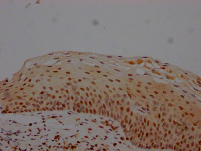 IHC image of RAC07517 diluted at 1:100 and staining in paraffin-embedded human tonsil tissue performed on a Leica BondTM system. After dewaxing and hydration, antigen retrieval was mediated by high pressure in a citrate buffer (pH 6.0). Section was blocked with 10% normal goat serum 30min at RT. Then primary antibody (1% BSA) was incubated at 4? overnight. The primary is detected by a Goat anti-rabbit IgG polymer labeled by HRP and visualized using 0.05% DAB.