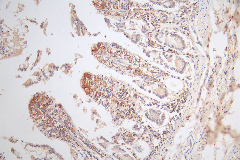 IHC image of RAC07518 diluted at 1:80 and staining in paraffin-embedded human small intestine tissue performed on a Leica BondTM system. After dewaxing and hydration, antigen retrieval was mediated by high pressure in a citrate buffer (pH 6.0). Section was blocked with 10% normal goat serum 30min at RT. Then primary antibody (1% BSA) was incubated at 4Â°C overnight. The primary is detected by a Goat anti-rabbit polymer IgG labeled by HRP and visualized using 0.49% DAB.