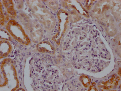 IHC image of RAC07521 diluted at 1:100 and staining in paraffin-embedded human kidney tissue performed on a Leica BondTM system. After dewaxing and hydration, antigen retrieval was mediated by high pressure in a citrate buffer (pH 6.0). Section was blocked with 10% normal goat serum 30min at RT. Then primary antibody (1% BSA) was incubated at 4? overnight. The primary is detected by a Goat anti-rabbit IgG polymer labeled by HRP and visualized using 0.05% DAB.