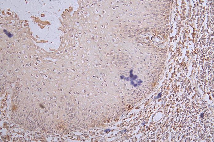IHC image of RAC07522 diluted at 1:100 and staining in paraffin-embedded human tonsil tissue performed on a Leica BondTM system. After dewaxing and hydration, antigen retrieval was mediated by high pressure in a citrate buffer (pH 6.0). Section was blocked with 10% normal goat serum 30min at RT. Then primary antibody (1% BSA) was incubated at 4Â°C overnight. The primary is detected by a Goat anti-rabbit polymer IgG labeled by HRP and visualized using 0.65% DAB.