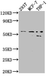 Western Blot; Positive WB detected in: 293T whole cell lysate, MCF-7 whole cell lysate, THP-1 whole cell lysate; All lanes: MMP12 antibody at 1:1000; Secondary; Goat polyclonal to rabbit IgG at 1/50000 dilution; Predicted band size: 55 kDa; Observed band size: 54, 45 kDa