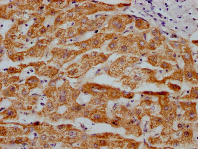 IHC image of RAC07525 diluted at 1:100 and staining in paraffin-embedded human liver tissue performed on a Leica BondTM system. After dewaxing and hydration, antigen retrieval was mediated by high pressure in a citrate buffer (pH 6.0). Section was blocked with 10% normal goat serum 30min at RT. Then primary antibody (1% BSA) was incubated at 4? overnight. The primary is detected by a Goat anti-rabbit IgG polymer labeled by HRP and visualized using 0.05% DAB.