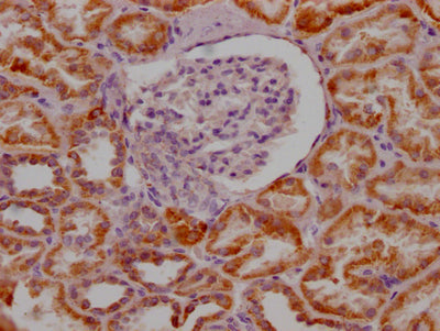 IHC image of RAC07525 diluted at 1:100 and staining in paraffin-embedded human kidney tissue performed on a Leica BondTM system. After dewaxing and hydration, antigen retrieval was mediated by high pressure in a citrate buffer (pH 6.0). Section was blocked with 10% normal goat serum 30min at RT. Then primary antibody (1% BSA) was incubated at 4? overnight. The primary is detected by a Goat anti-rabbit IgG polymer labeled by HRP and visualized using 0.05% DAB.