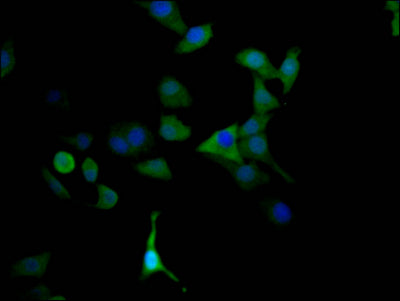 Immunofluorescence staining of HepG2 Cells with RAC07525 at 1:50, counter-stained with DAPI. The cells were fixed in 4% formaldehyde, permeated by 0.2% TritonX-100, and blocked in 10% normal Goat Serum. The cells were then incubated with the antibody overnight at 4?. Nuclear DNA was labeled in blue with DAPI. The secondary antibody was FITC-conjugated AffiniPure Goat Anti-Rabbit IgG (H+L).