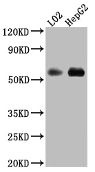 Western Blot; Positive WB detected in: L02 whole cell lysate, HepG2 whole cell lysate; All lanes: Monoamine Oxidase B Antibody at 1:1000; Secondary; Goat polyclonal to rabbit IgG at 1/50000 dilution; Predicted band size: 59, 47 kDa; Observed band size: 59 kDa