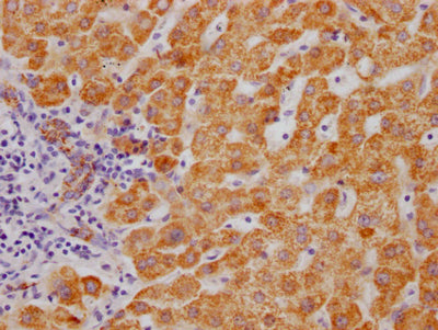 IHC image of RAC07526 diluted at 1:100 and staining in paraffin-embedded human liver tissue performed on a Leica BondTM system. After dewaxing and hydration, antigen retrieval was mediated by high pressure in a citrate buffer (pH 6.0). Section was blocked with 10% normal goat serum 30min at RT. Then primary antibody (1% BSA) was incubated at 4? overnight. The primary is detected by a Goat anti-rabbit IgG polymer labeled by HRP and visualized using 0.05% DAB.
