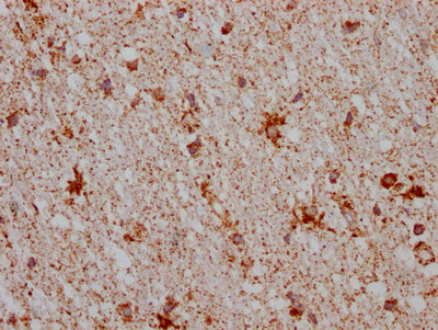 IHC image of RAC07526 diluted at 1:100 and staining in paraffin-embedded human brain tissue performed on a Leica BondTM system. After dewaxing and hydration, antigen retrieval was mediated by high pressure in a citrate buffer (pH 6.0). Section was blocked with 10% normal goat serum 30min at RT. Then primary antibody (1% BSA) was incubated at 4? overnight. The primary is detected by a Goat anti-rabbit IgG polymer labeled by HRP and visualized using 0.05% DAB.