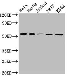 Western Blot; Positive WB detected in: Hela whole cell lysate, HepG2 whole cell lysate, Jurkat whole cell lysate, 293T whole cell lysate, K562 whole cell lysate; All lanes: MCT1 antibody at 1:1000; Secondary; Goat polyclonal to rabbit IgG at 1/50000 dilution; Predicted band size: 54, 47 kDa; Observed band size: 54 kDa