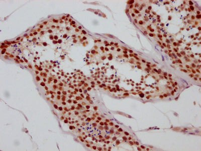 IHC image of RAC07529 diluted at 1:100 and staining in paraffin-embedded human testis tissue performed on a Leica BondTM system. After dewaxing and hydration, antigen retrieval was mediated by high pressure in a citrate buffer (pH 6.0). Section was blocked with 10% normal goat serum 30min at RT. Then primary antibody (1% BSA) was incubated at 4? overnight. The primary is detected by a Goat anti-rabbit IgG polymer labeled by HRP and visualized using 0.05% DAB.