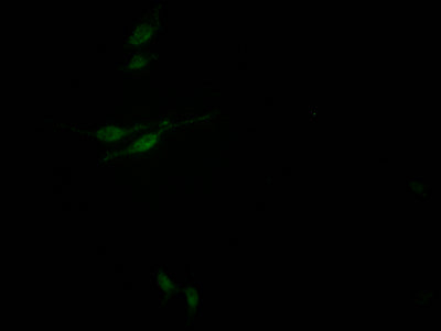 Immunofluorescence staining of HepG2 Cells with RAC07529 at 1:50, counter-stained with DAPI. The cells were fixed in 4% formaldehyde, permeated by 0.2% TritonX-100, and blocked in 10% normal Goat Serum. The cells were then incubated with the antibody overnight at 4?. Nuclear DNA was labeled in blue with DAPI. The secondary antibody was FITC-conjugated AffiniPure Goat Anti-Rabbit IgG (H+L).