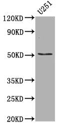 Western Blot; Positive WB detected in: U-251 whole cell lysate; All lanes: Mutant p53 antibody at 1:1000; Secondary; Goat polyclonal to rabbit IgG at 1/50000 dilution; Predicted band size: 38, 39, 40, 34, 35, 30, 24, 25 kDa; Observed band size: 53 kDa
