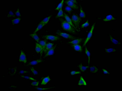 Immunofluorescence staining of HepG2 Cells with RAC07531 at 1:50, counter-stained with DAPI. The cells were fixed in 4% formaldehyde, permeated by 0.2% TritonX-100, and blocked in 10% normal Goat Serum. The cells were then incubated with the antibody overnight at 4?. Nuclear DNA was labeled in blue with DAPI. The secondary antibody was FITC-conjugated AffiniPure Goat Anti-Rabbit IgG (H+L).
