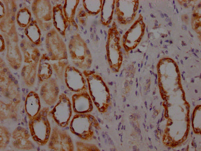 IHC image of RAC07532 diluted at 1:100 and staining in paraffin-embedded human kidney tissue performed on a Leica BondTM system. After dewaxing and hydration, antigen retrieval was mediated by high pressure in a citrate buffer (pH 6.0). Section was blocked with 10% normal goat serum 30min at RT. Then primary antibody (1% BSA) was incubated at 4? overnight. The primary is detected by a Goat anti-rabbit IgG polymer labeled by HRP and visualized using 0.05% DAB.