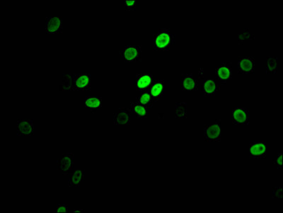 Immunofluorescence staining of HepG2 Cells with RAC07532 at 1:50, counter-stained with DAPI. The cells were fixed in 4% formaldehyde, permeated by 0.2% TritonX-100, and blocked in 10% normal Goat Serum. The cells were then incubated with the antibody overnight at 4?. Nuclear DNA was labeled in blue with DAPI. The secondary antibody was FITC-conjugated AffiniPure Goat Anti-Rabbit IgG (H+L).