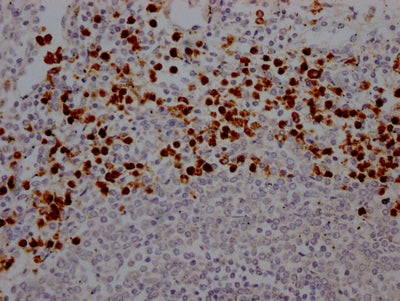 IHC image of RAC07533 diluted at 1:100 and staining in paraffin-embedded human spleen tissue performed on a Leica BondTM system. After dewaxing and hydration, antigen retrieval was mediated by high pressure in a citrate buffer (pH 6.0). Section was blocked with 10% normal goat serum 30min at RT. Then primary antibody (1% BSA) was incubated at 4? overnight. The primary is detected by a Goat anti-rabbit IgG polymer labeled by HRP and visualized using 0.05% DAB.