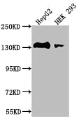 Western Blot; Positive WB detected in: HepG2 whole cell lysate, HEK293 whole cell lysate; All lanes: MYLK antibody at 1:2000; Secondary; Goat polyclonal to rabbit IgG at 1/50000 dilution; Predicted band size: 211, 204, 206, 198, 203, 111, 17, 81 kDa; Observed band size: 130-250 kDa