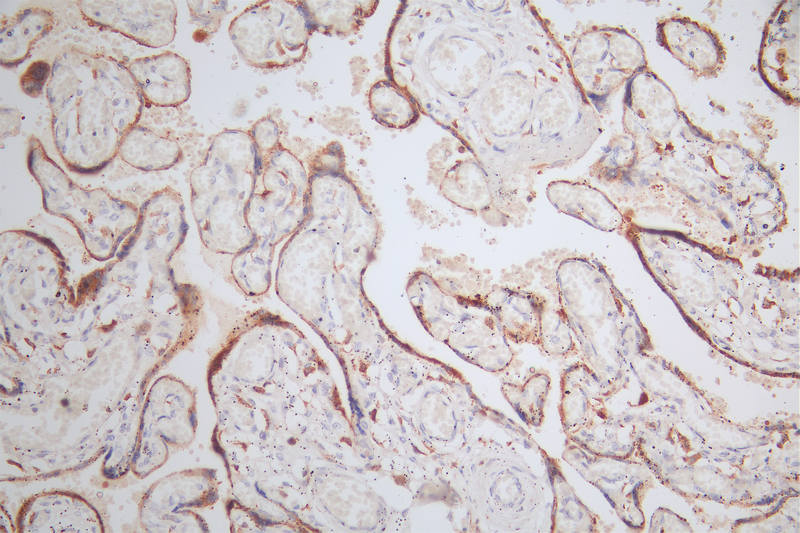 IHC image of RAC07537 diluted at 1:80 and staining in paraffin-embedded human placenta tissue performed on a Leica BondTM system. After dewaxing and hydration, antigen retrieval was mediated by high pressure in a citrate buffer (pH 6.0). Section was blocked with 10% normal goat serum 30min at RT. Then primary antibody (1% BSA) was incubated at 4Â°C overnight. The primary is detected by a Goat anti-rabbit polymer IgG labeled by HRP and visualized using 0.48% DAB.