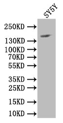 Western Blot; Positive WB detected in: SY5Y whole cell lysate; All lanes: NCAM antibody at 1:1000; Secondary; Goat polyclonal to rabbit IgG at 1/50000 dilution; Predicted band size: 120-220 kDa; Observed band size: 150 kDa