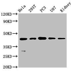 Western Blot; Positive WB detected in: Hela whole cell lysate, 293T whole cell lysate, PC3 whole cell lysate, U87 whole cell lysate, Mouse kidney tissue; All lanes: NDRG1 antibody at 0.7ug/ml; Secondary; Goat polyclonal to rabbit IgG at 1/50000 dilution; Predicted band size: 43, 36, 34 KDa; Observed band size: 43 KDa