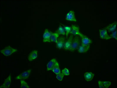 Immunofluorescence staining of Hela cells with RAC07540 at 1:23, counter-stained with DAPI. The cells were fixed in 4% formaldehyde, permeabilized using 0.2% Triton X-100 and blocked in 10% normal Goat Serum. The cells were then incubated with the antibody overnight at 4?. The secondary antibody was Alexa Fluor 488-congugated AffiniPure Goat Anti-Rabbit IgG (H+L).