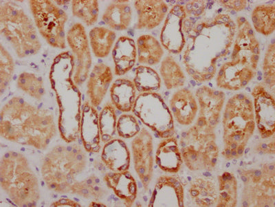 IHC image of RAC07541 diluted at 1:100 and staining in paraffin-embedded human kidney tissue performed on a Leica BondTM system. After dewaxing and hydration, antigen retrieval was mediated by high pressure in a citrate buffer (pH 6.0). Section was blocked with 10% normal goat serum 30min at RT. Then primary antibody (1% BSA) was incubated at 4? overnight. The primary is detected by a Goat anti-rabbit IgG polymer labeled by HRP and visualized using 0.05% DAB.