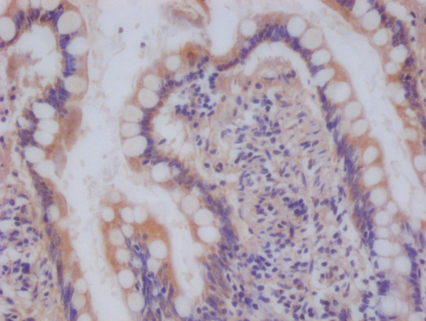 IHC image of RAC07542 diluted at 1:100 and staining in paraffin-embedded human small intestine tissue performed on a Leica BondTM system. After dewaxing and hydration, antigen retrieval was mediated by high pressure in a citrate buffer (pH 6.0). Section was blocked with 10% normal goat serum 30min at RT. Then primary antibody (1% BSA) was incubated at 4Â°C overnight. The primary is detected by a Goat anti-rabbit polymer IgG labeled by HRP and visualized using 0.05% DAB.