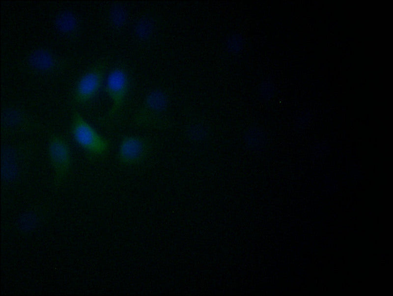 Immunofluorescence staining of A549 with RAC07543 at 1:60, counter-stained with DAPI. The cells were fixed in 4% formaldehyde and blocked in 10% normal Goat Serum. The cells were then incubated with the antibody overnight at 4Â°C. The secondary antibody was Alexa Fluor 522-congugated AffiniPure Goat Anti-Rabbit IgG(H+L).